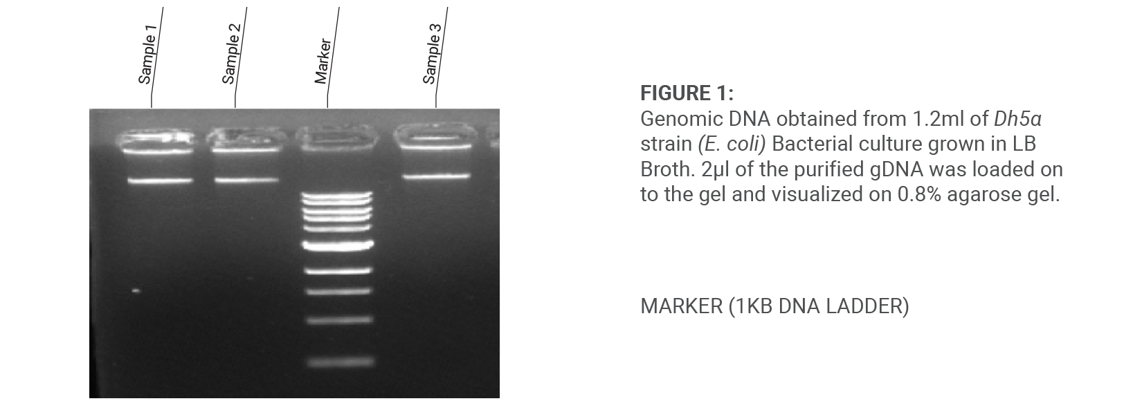 DNA Bioanalyzer