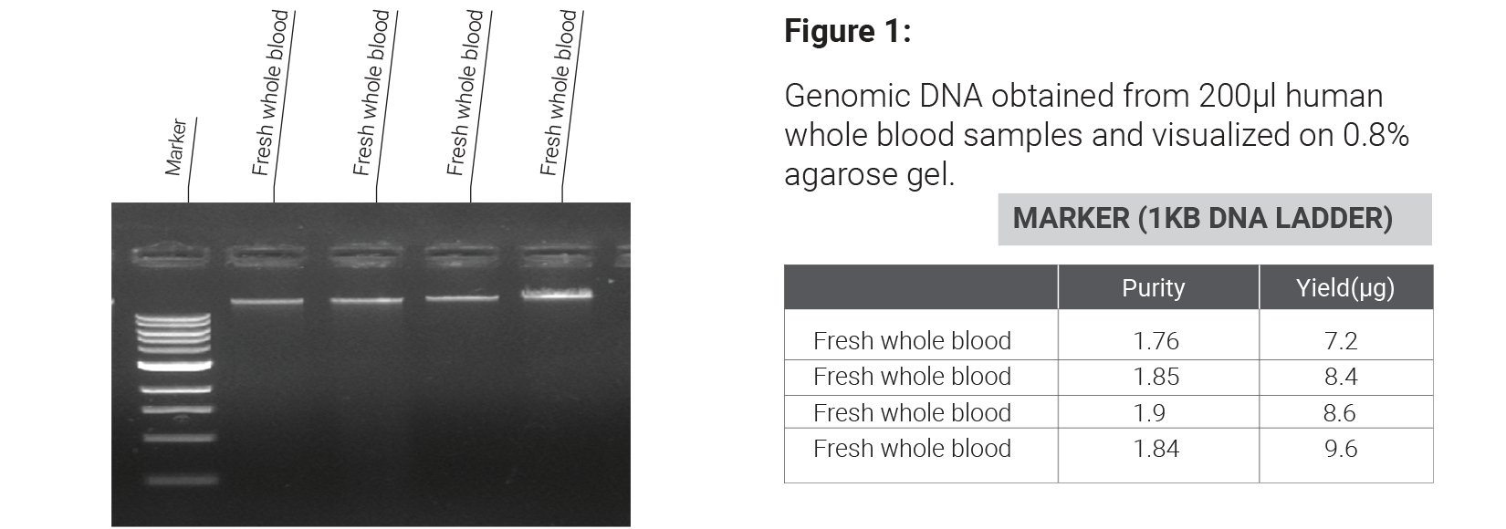 Blood DNA Extraction 