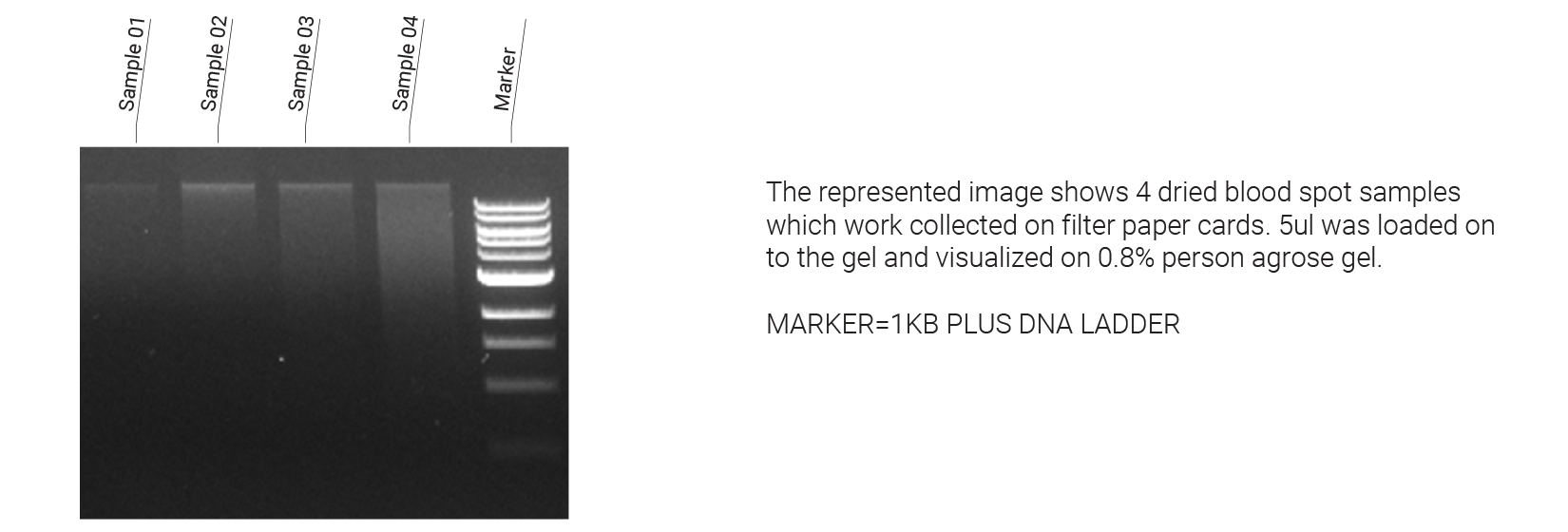 TB-Q Real Time PCR Kit