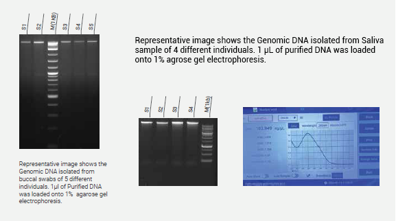 DNA Bioanalyzer