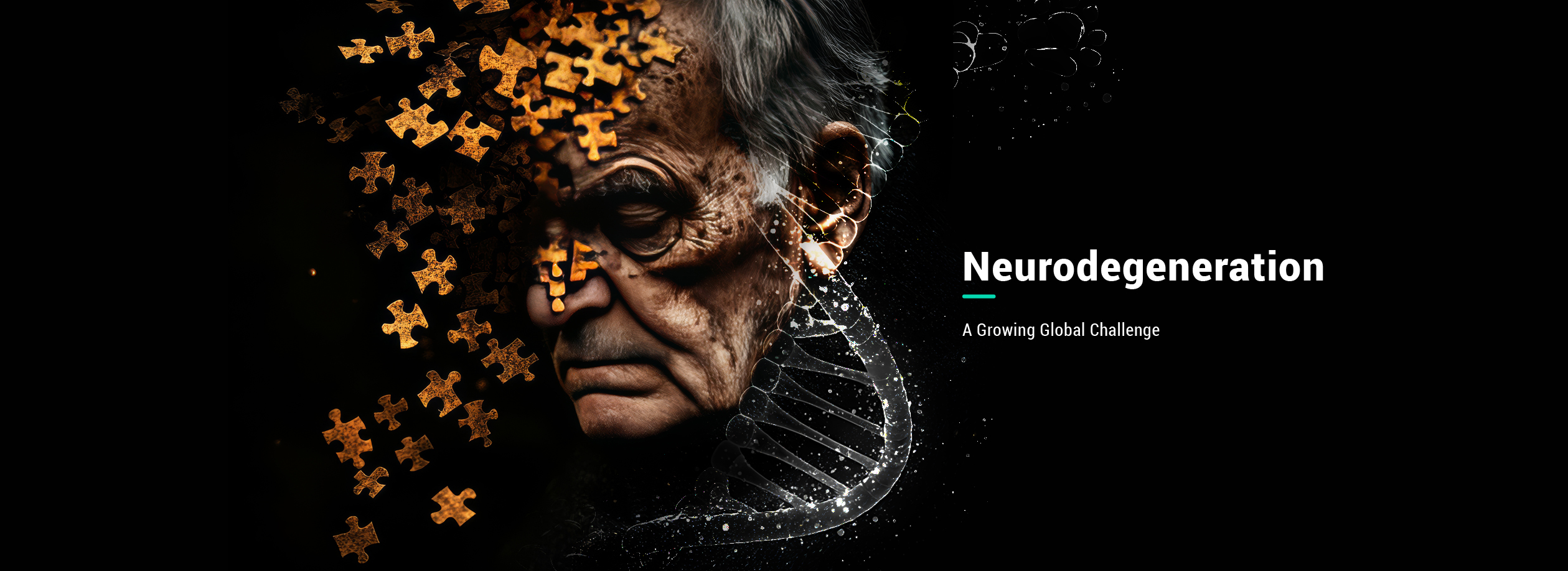 Alzheimer Parkinsons