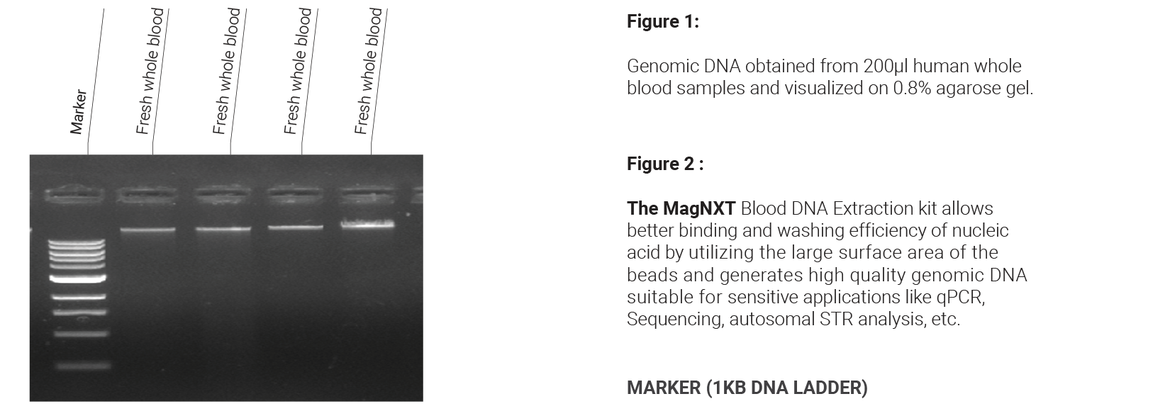 Blood DNA Extraction Kits