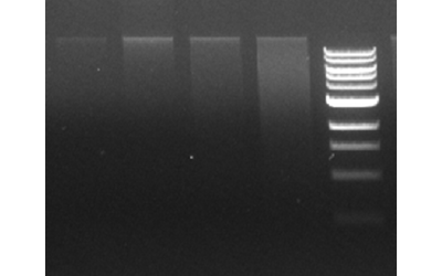 DBS DNA Extraction Kit