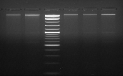 Forensic DNA Extraction Kit