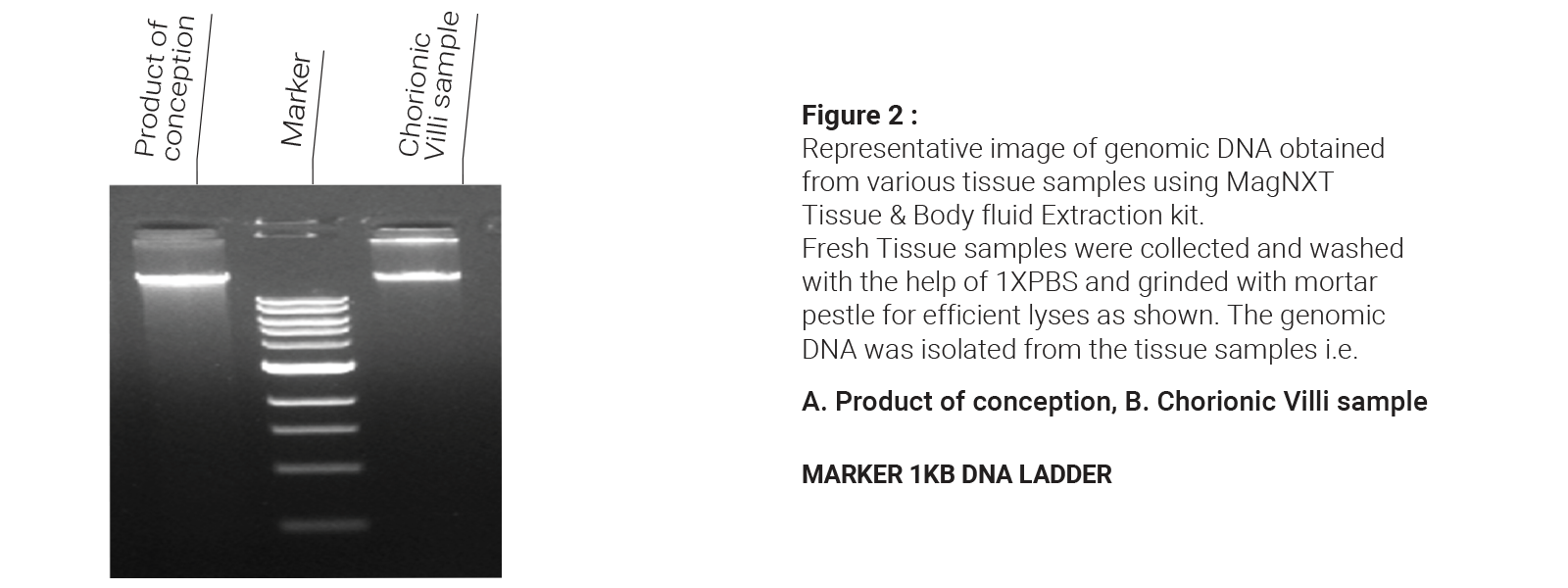 DNA Extraction Kits