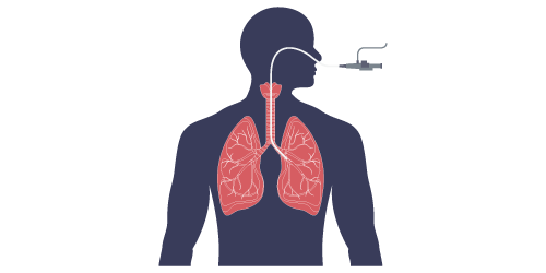 In vitro RT-PCR Diagnostic Solutions