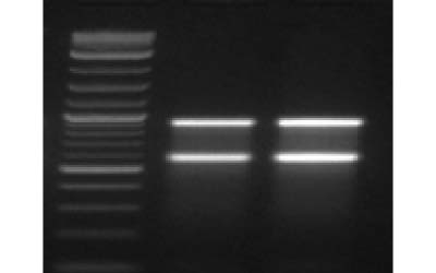 Bacterial DNA Extraction kit