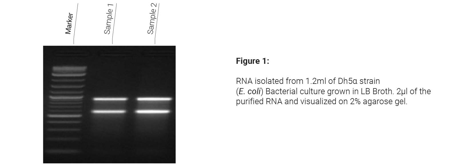 Bacterial DNA Extraction kit