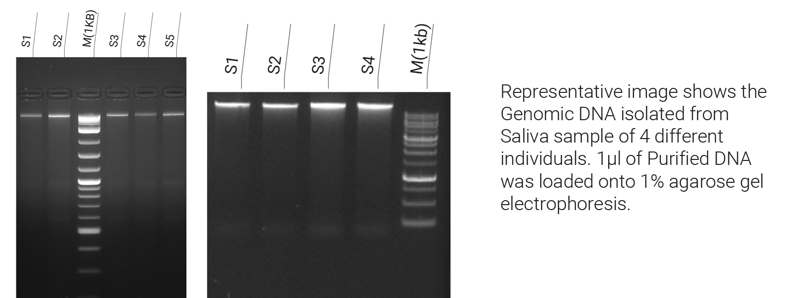 Saliva DNA Extraction Kit